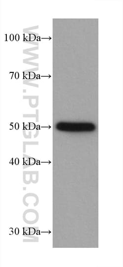 P53 Rabbit Recombinant Antibody, Proteintech:Antibodies:Primary Antibodies
