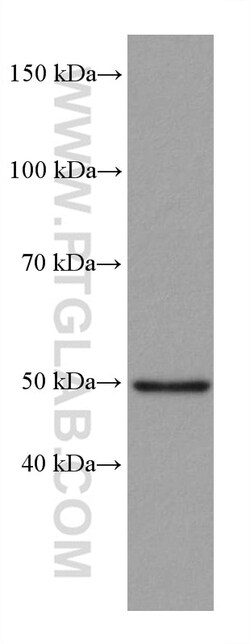 P53 Rabbit Recombinant Antibody, Proteintech:Antibodies:Primary Antibodies