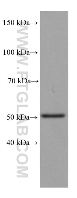 P53 Rabbit Recombinant Antibody, Proteintech:Antibodies:Primary Antibodies