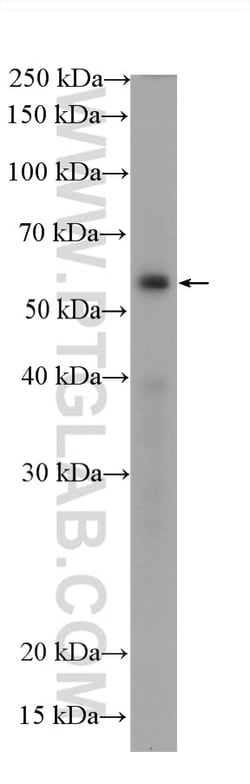 P53 Rabbit Recombinant Antibody, Proteintech:Antibodies:Primary Antibodies