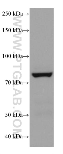 P5CS Mouse Monoclonal Antibody, Proteintech:Antibodies:Primary Antibodies