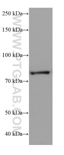 P5CS Mouse Monoclonal Antibody, Proteintech:Antibodies:Primary Antibodies
