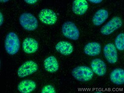CoraLite Plus 488-conjugated PABPN1 Mouse Monoclonal Antibody, Proteintech:Antibodies:Primary