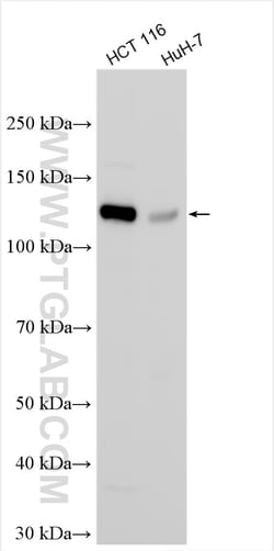 PACS2 Rabbit Polyclonal Antibody, Proteintech Unconjugated; 20 &mu;L:Antibodies,
