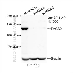 PACS2 Rabbit Polyclonal Antibody, Proteintech Unconjugated; 20 &mu;L:Antibodies,