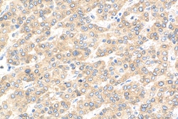 PAIP1 Mouse Monoclonal Antibody, Proteintech Unconjugated; 20 &mu;L:Antibodies,