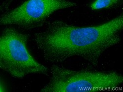 PAK4 Mouse Monoclonal Antibody, Proteintech Unconjugated; 20 &mu;L:Antibodies,