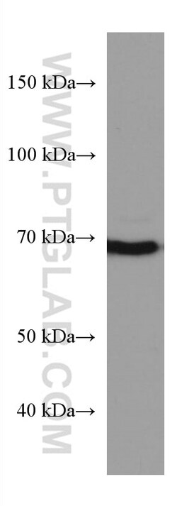 PAK6 Mouse Monoclonal Antibody, Proteintech:Antistoffer:Primære antistoffer