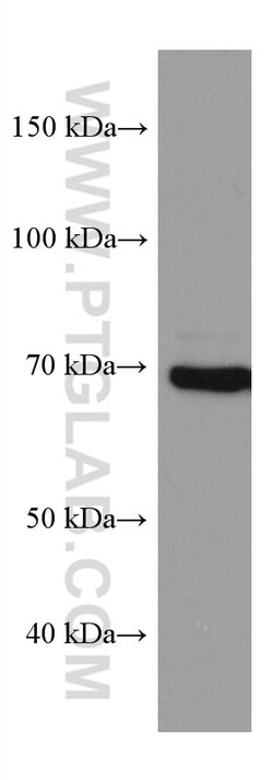 PAK6 Mouse Monoclonal Antibody, Proteintech:Antistoffer:Primære antistoffer