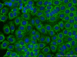 Proteintech CoraLite™ Plus 488-conjugated PARD3 Mouse Monoclonal Antibody, Proteintech