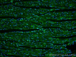 CoraLite Plus 488-conjugated PARK2/Parkin Rabbit Polyclonal Antibody, Proteintech:Antibodies:Primary