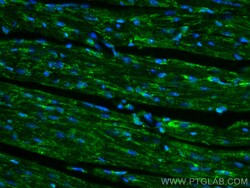 CoraLite Plus 488-conjugated PARK2/Parkin Rabbit Polyclonal Antibody, Proteintech:Antibodies:Primary