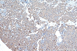Biotin-conjugated PARK7/DJ-1 Rabbit Polyclonal Antibody, Proteintech:Antibodies:Primary