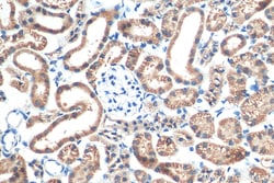 Biotin-conjugated PARK7/DJ-1 Rabbit Polyclonal Antibody, Proteintech:Antibodies:Primary