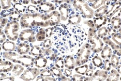 PAX2 Rabbit Polyclonal Antibody, Proteintech Unconjugated; 150 &mu;L:Antibodies,