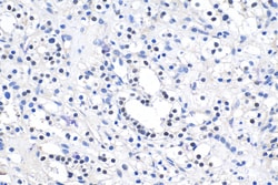 PAX2 Rabbit Polyclonal Antibody, Proteintech Unconjugated; 150 &mu;L:Antibodies,