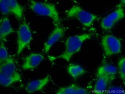 PBLD Mouse Monoclonal Antibody, Proteintech:Antibodies:Primary Antibodies
