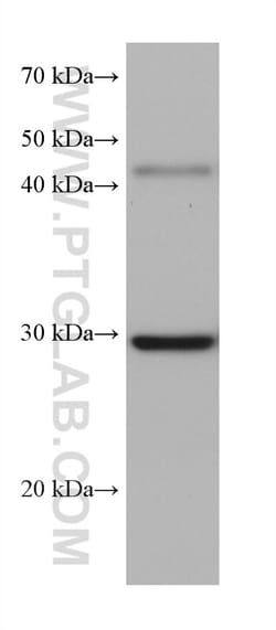 PBLD Mouse Monoclonal Antibody, Proteintech:Antibodies:Primary Antibodies