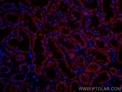 PCCB Mouse anti-Pig, Rat, Mouse, Human, CoraLite 594, Clone: 1A9A5, Proteintech