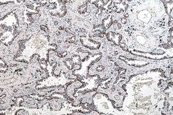 PCK2 Mouse Monoclonal Antibody, Proteintech Unconjugated; 150 &mu;L:Antibodies,