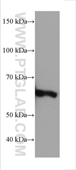 PCK2 Mouse Monoclonal Antibody, Proteintech Unconjugated; 150 &mu;L:Antibodies,