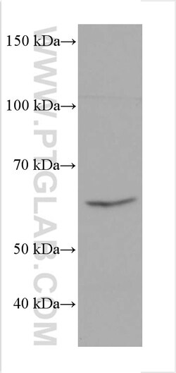 PCK2 Mouse Monoclonal Antibody, Proteintech Unconjugated; 150 &mu;L:Antibodies,