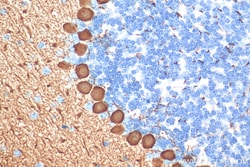 PCP2 Rabbit Polyclonal Antibody, Proteintech:Antibodies:Primary Antibodies