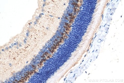 PCP2 Rabbit Polyclonal Antibody, Proteintech:Antibodies:Primary Antibodies