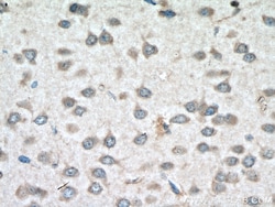 PCSK1 Rabbit Polyclonal Antibody, Proteintech Unconjugated; 150 &mu;L:Antibodies,