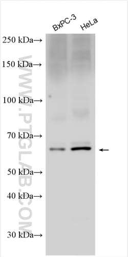 PCSK1 Rabbit Polyclonal Antibody, Proteintech Unconjugated; 150 &mu;L:Antibodies,