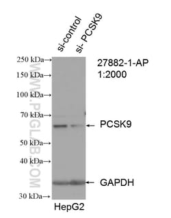 PCSK9 Rabbit Polyclonal Antibody, Proteintech Unconjugated; 20 &mu;L:Antibodies,