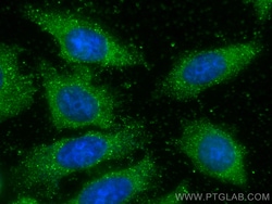 PCYT2 Mouse Monoclonal Antibody, Proteintech Unconjugated; 150 &mu;L:Antibodies,