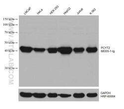 PCYT2 Mouse Monoclonal Antibody, Proteintech Unconjugated; 150 &mu;L:Antibodies,