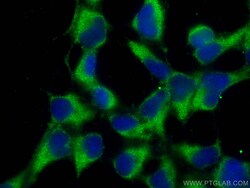 PDCD2L Mouse Monoclonal Antibody, Proteintech Unconjugated; 150 &mu;L:Antibodies,