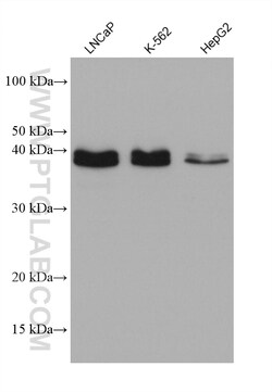 PDCD2L Mouse Monoclonal Antibody, Proteintech Unconjugated; 150 &mu;L:Antibodies,