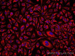 PDHB Mouse Monoclonal Antibody, Proteintech Unconjugated; 150 &mu;L:Antibodies,