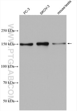 PDS5B Rabbit Polyclonal Antibody, Proteintech Unconjugated; 20 &mu;L:Antibodies,