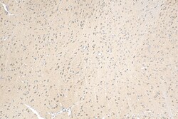 PDZ-GEF2 Rabbit Polyclonal Antibody, Proteintech Unconjugated; 20 &mu;L:Antibodies,