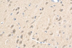 PDZ-GEF2 Rabbit Polyclonal Antibody, Proteintech Unconjugated; 20 &mu;L:Antibodies,