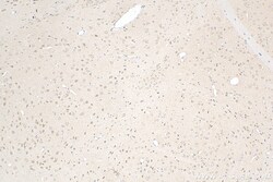 PDZ-GEF2 Rabbit Polyclonal Antibody, Proteintech Unconjugated; 20 &mu;L:Antibodies,