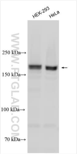 PDZ-GEF2 Rabbit Polyclonal Antibody, Proteintech Unconjugated; 20 &mu;L:Antibodies,