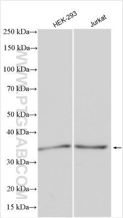 PDZD2 Rabbit Polyclonal Antibody, Proteintech Unconjugated; 20 &mu;L:Antibodies,