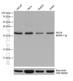 PECR Mouse Monoclonal Antibody, Proteintech:Antibodies:Primary Antibodies