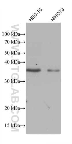 PECR Mouse Monoclonal Antibody, Proteintech:Antibodies:Primary Antibodies