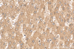 PELP1 Rabbit Polyclonal Antibody, Proteintech Unconjugated; 20 &mu;L:Antibodies,