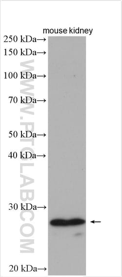 PEX11A Rabbit Polyclonal Antibody, Proteintech Unconjugated; 20 &mu;L:Antibodies,