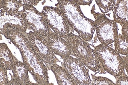 PFKFB4 Rabbit Polyclonal Antibody, Proteintech Unconjugated; 20 &mu;L:Antibodies,