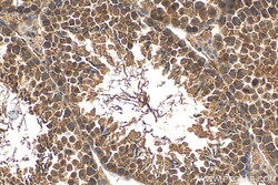 PFKFB4 Rabbit Polyclonal Antibody, Proteintech Unconjugated; 20 &mu;L:Antibodies,