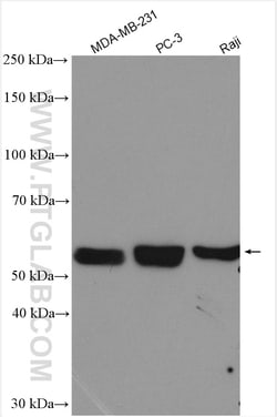 PFKFB4 Rabbit Polyclonal Antibody, Proteintech Unconjugated; 20 &mu;L:Antibodies,