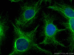 PFKL Mouse Monoclonal Antibody, Proteintech:Antibodies:Primary Antibodies